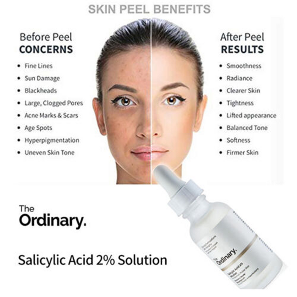 The Ordinary Salicylic Acid 2% Solution 30ml - Acne Prone Skin