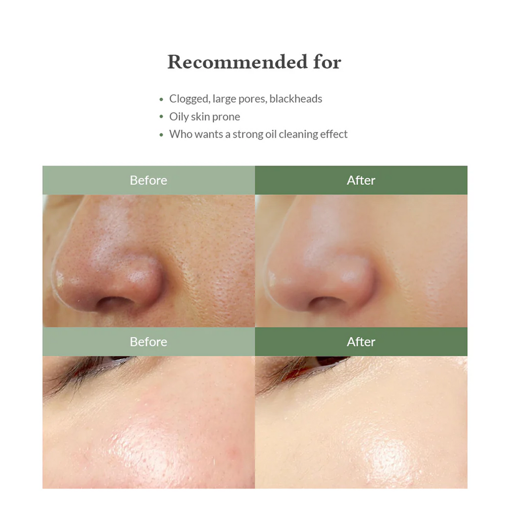 Before and After usage of Dr.Althea Premium Quick Step Sebum Cleanser