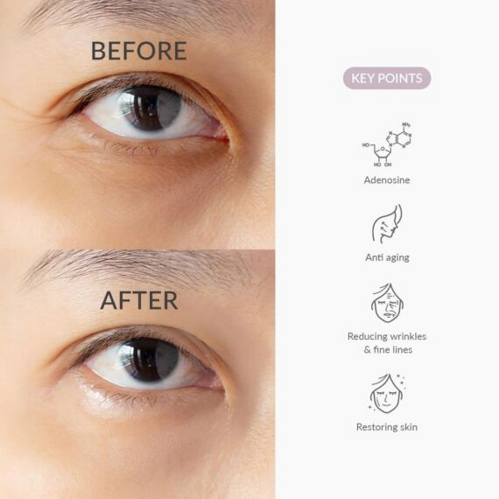 Before and fter usage of Dr. Althea To Be Youthful Eye Serum