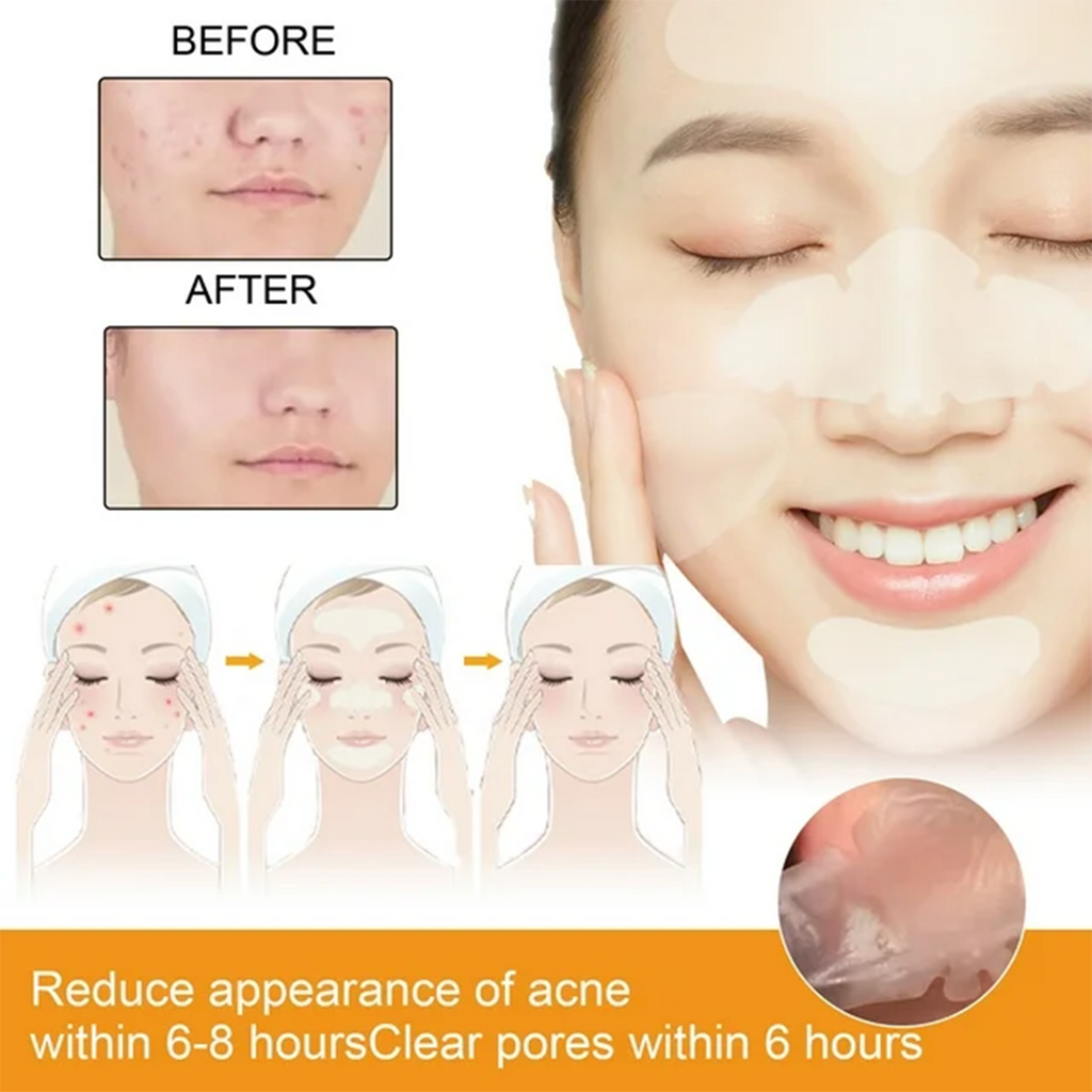 Eelhoe Hydrocolloid Face Patch - 4pcs, crafted with advanced hydrocolloid technology for quick healing and discreet blemish care.