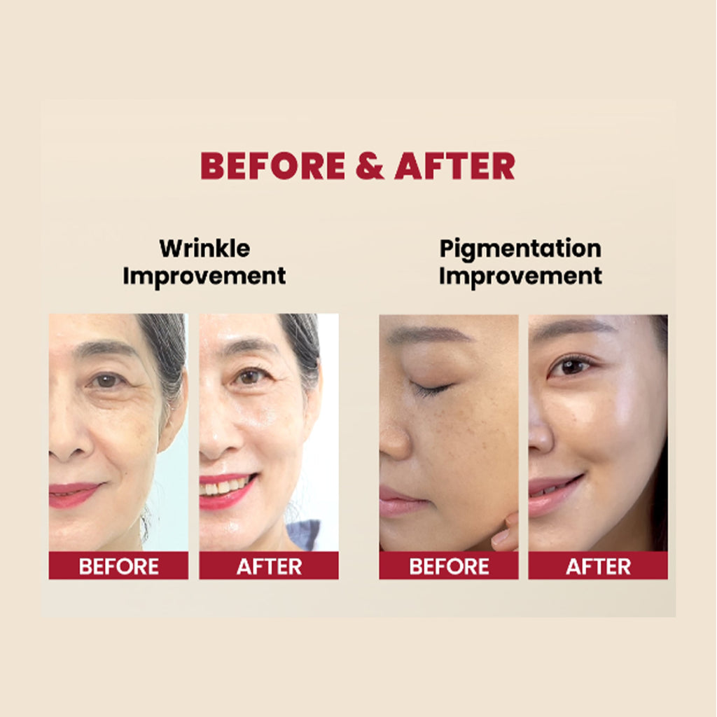 Before and After usage of K-SECRET Seoul 1988 Age Repair & Brightening Set