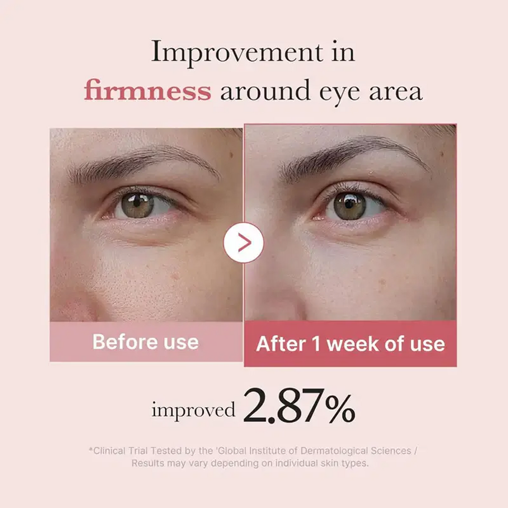 The Key Benefits of Medicube PDRN Pink Peptide Eye Cream