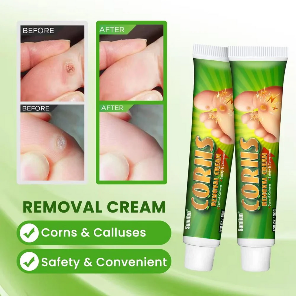 The Key Benefits of Sumifun Corns Removal Cream