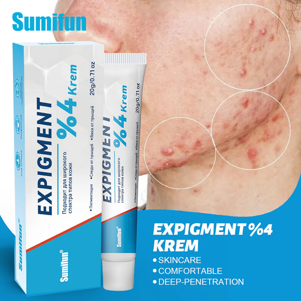 Key Benefits of Sumifun Expigment 4 percent Krem