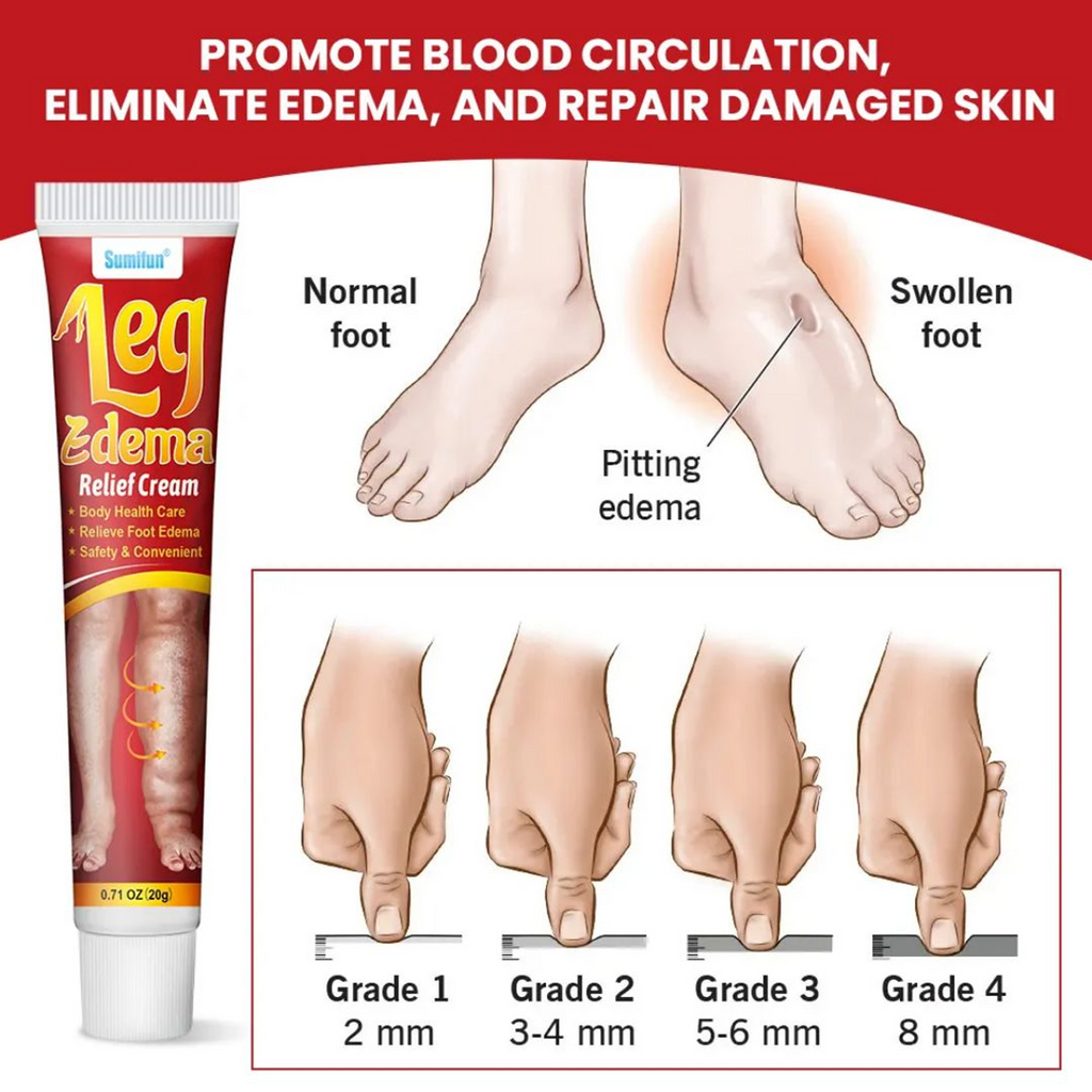 The Key Benefits of Sumifun Leg Edema Relief Cream