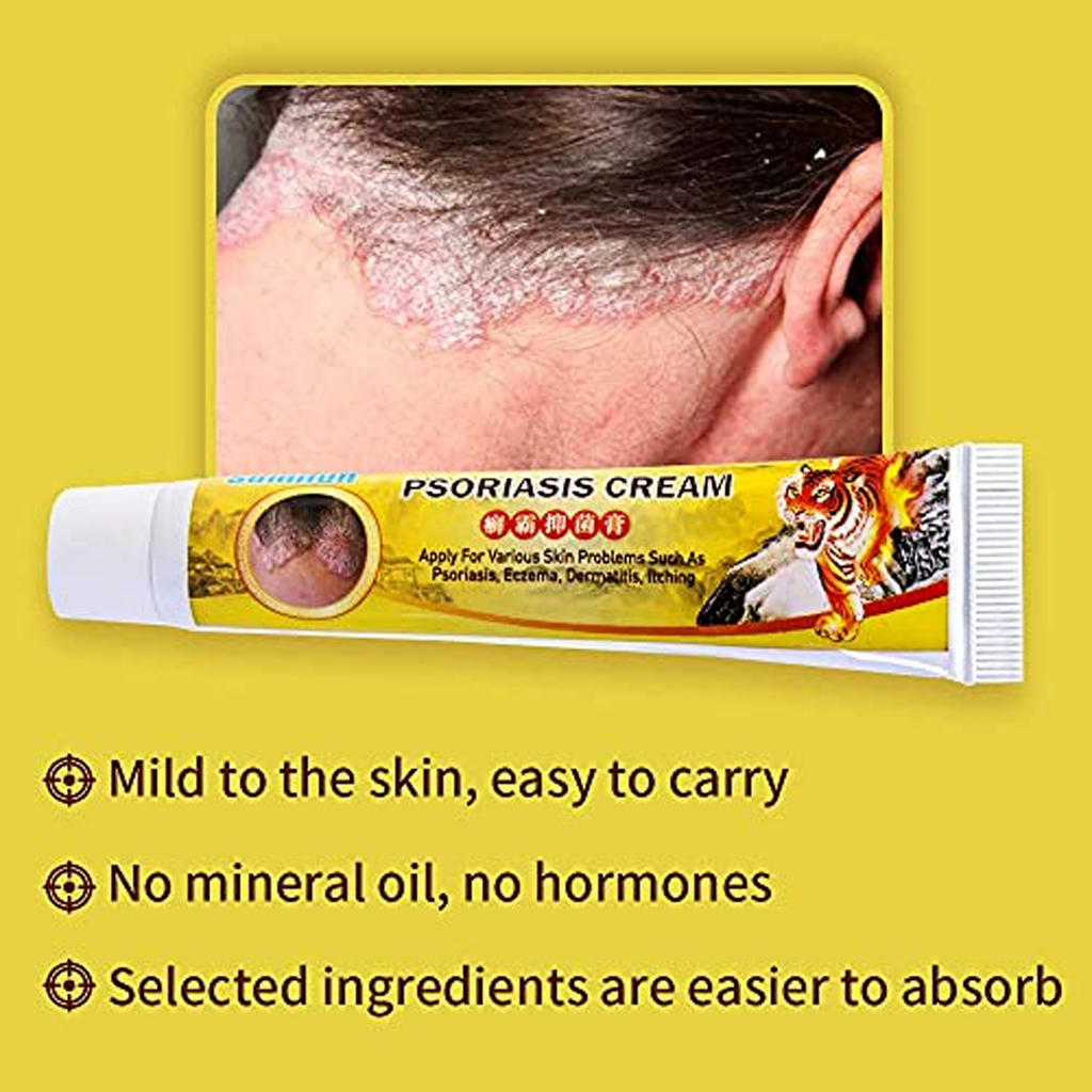 The Benefits of using Sumifun Psoriasis Cream 