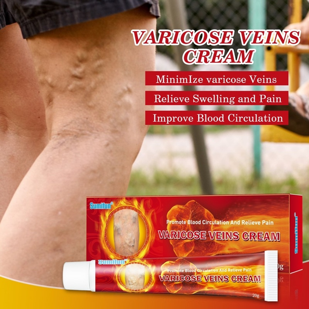 The Key Benefits of Sumifun Varicose Veins Cream