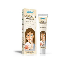 The Product of Sumifun Vitiligo Removal Cream