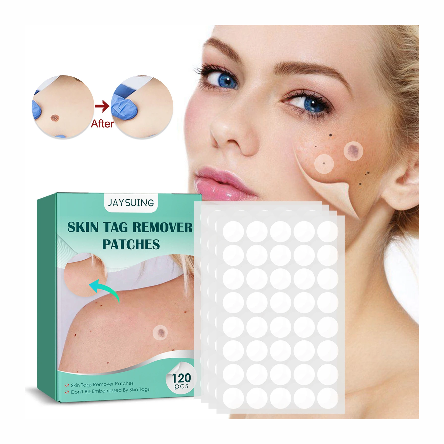 JAYSUING™ - Tags & Moles Remover – LuxuryTrends