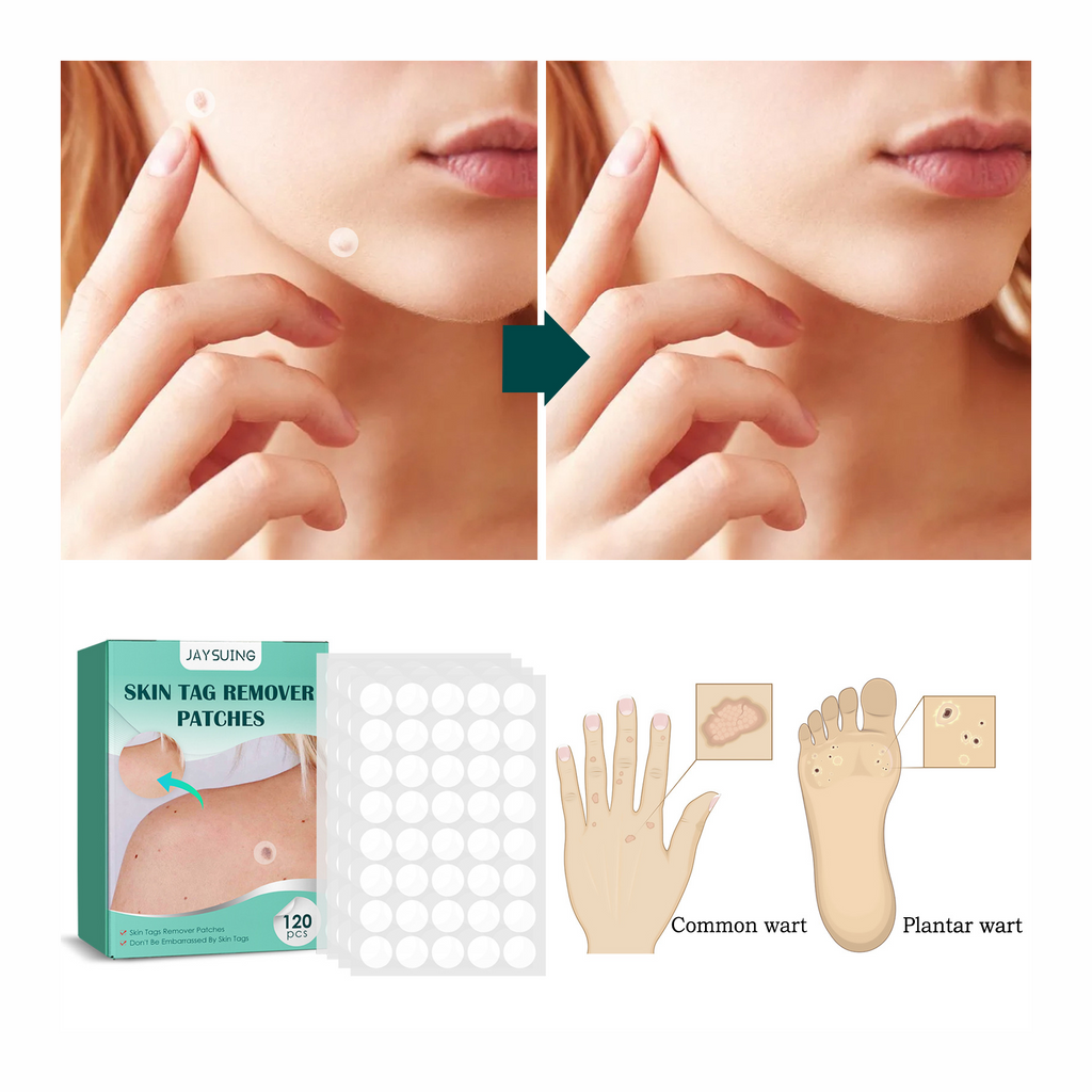 Jaysuing Skin Tag Removal Patches - 120 pcs. Instant relief from wart pain. 
