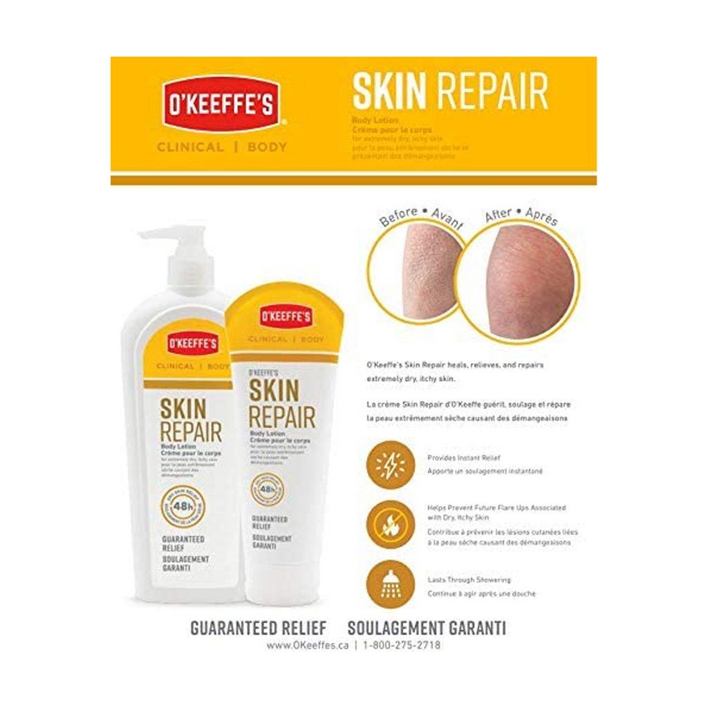 O'Keeffe's Skin Repair Body Lotion and Dry Skin Moisturizer, Tube, 198gm - For Extremely Dry and Itchy Skin