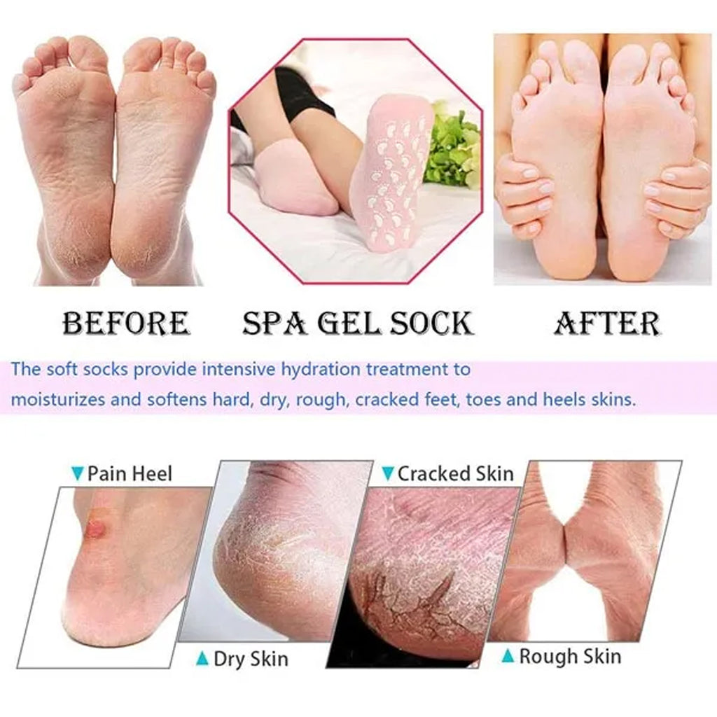 Spa Gel Socks for Cracked Feet