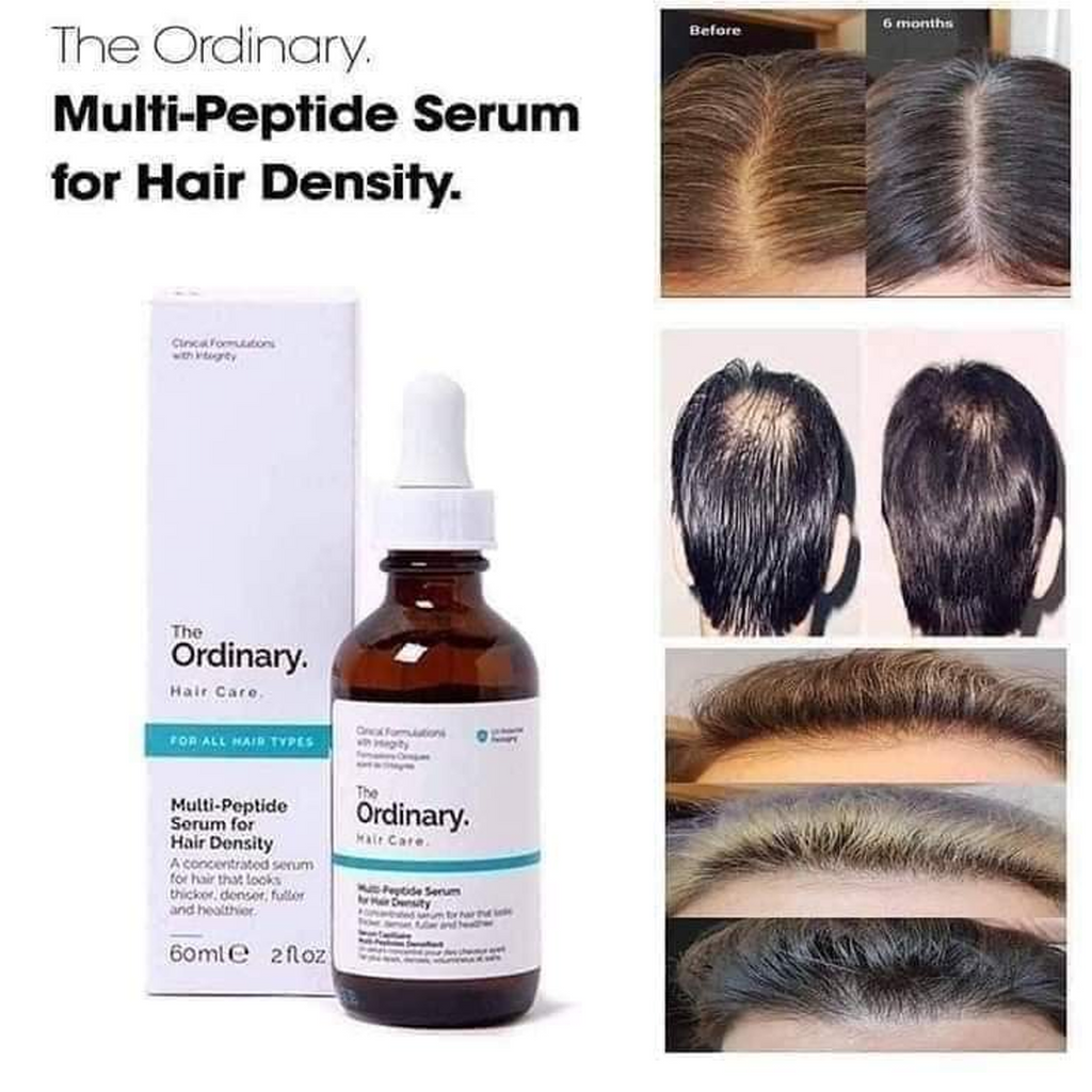 The Ordinary Multi-Peptide Serum for Hair Density, 60ml - A bottle of hair serum. 